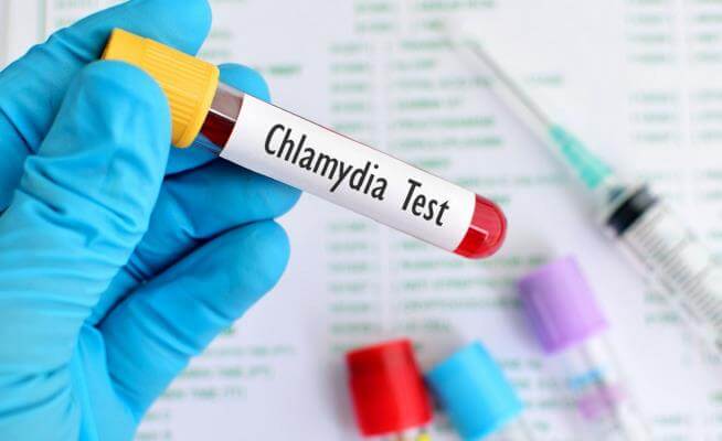 Bệnh Chlamydia Và Những Điều Cần Biết!